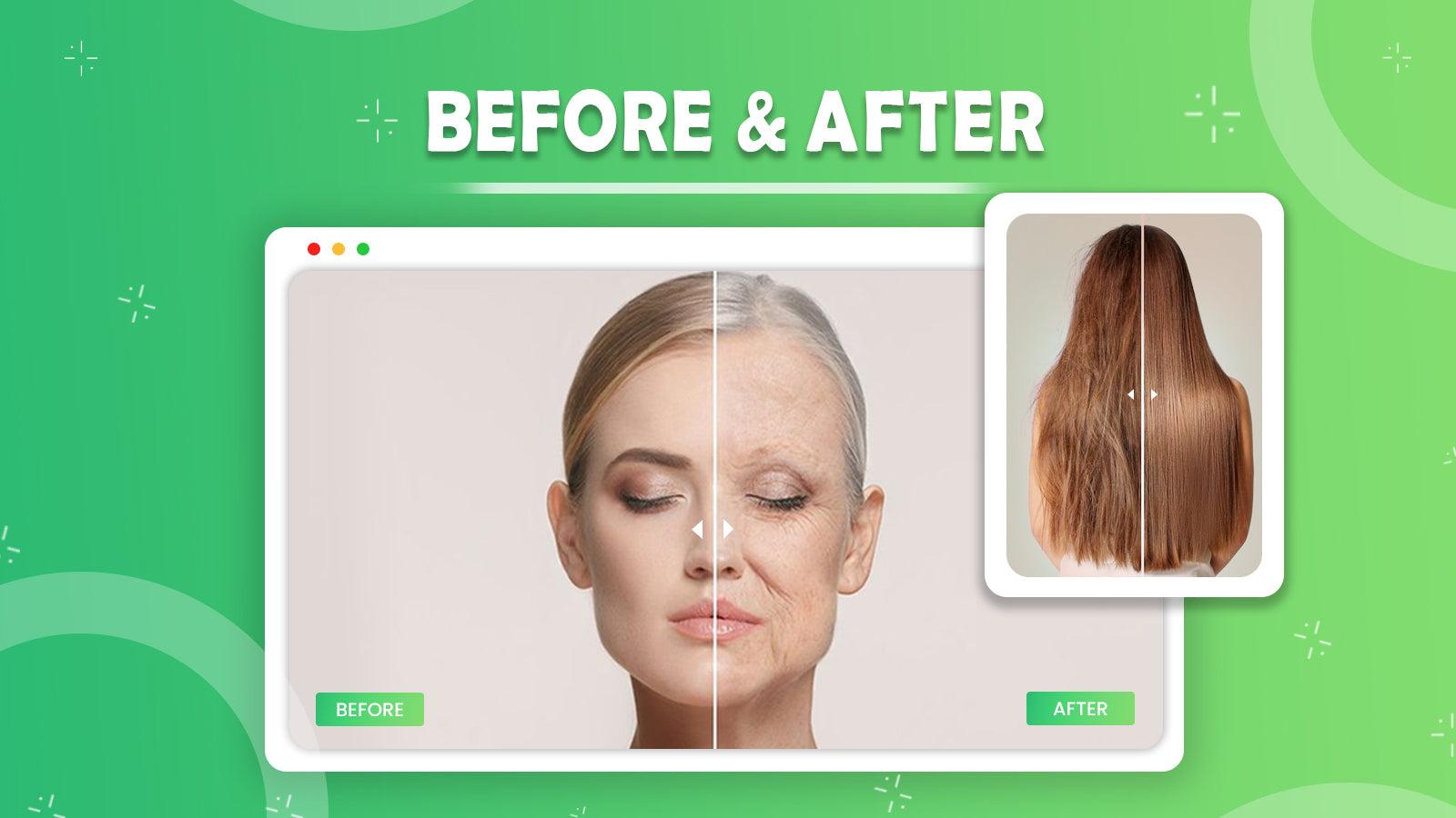 Before - After Widget banner